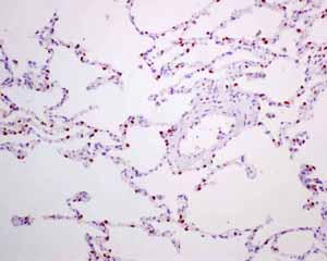 Immunohistochemical analysis using ab137061 showing positive staining in Normal lung tissue.