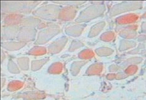 ab11083 at 1/4000 dilution, staining Slow Skeletal Myosin Heavy chain in rabbit tongue tissue section by Immunohistochemistry (Formalin/PFA-fixed paraffin embedded sections).