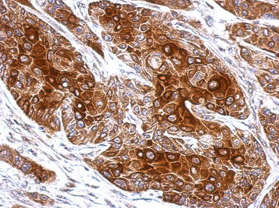 Immunohistochemical analysis of paraffin-embedded Cal27 xenograft tissue labeling TUB 1 with ab155201 at 1/500 dilution.