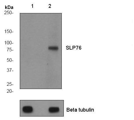 All lanes : Anti-SLP76 (phospho Y113) antibody [EPR2851] (ab75990) at 1/10000 dilutionLane 1 : Jurkat cell lysate - untreatedLane 2 : Jurkat cell lysate - treated with pervanadateLysates/proteins at 10 µg per lane.SecondaryHRP labelled goat anti-rabbit at 1/2000 dilution