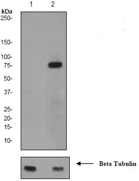 All lanes : Anti-SLP76 (phospho Y145) antibody [EP2853Y] (ab75829) at 1/200000 dilutionLane 1 : Jurkat cell lysates un-treatedLane 2 : Jurkat cell lysates treated with pervanadateLysates/proteins at 10 µg per lane.SecondaryHRP labelled goat anti-rabbit at 1/2000 dilution