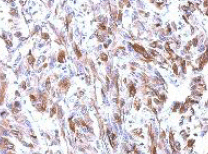 Immunohistochemical analysis of paraffin-embedded Mouse U251 xenograft tissue labeling TUBA1B with ab151424 at 1/500 dilution.