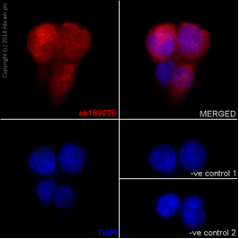Immunocytochemical analysis of A431 cells fixed in 4% paraformaldehyde labeling SIPA1 with ab189929 at 1/250 dilution, and Goat anti rabbit IgG(Alexa Fluor® 555) at 1/200 dilution as the secondary antibody. Counterstained with DAPI.