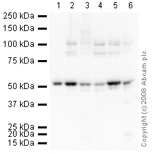 All lanes : Anti-Tubby antibody (ab46943) at 1 µg/mlLane 1 : Spinal Cord (Human) Tissue Lysate - adult normal tissue (ab29188)Lane 2 : Brain (Mouse) Tissue LysateLane 3 : Testis (Mouse) Tissue Lysate - normal tissueLane 4 : Spinal Cord (Mouse) Tissue LysateLane 5 : Brain (Rat) Tissue Lysate - normal tissueLane 6 : Rat Dorsal Root GanglionLysates/proteins at 10 µg per lane.SecondaryGoat polyclonal to Rabbit IgG - H&L - Pre-Adsorbed (HRP) at 1/3000 dilutionPerformed under reducing conditions.