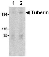 Lane 1 :  Anti-Tuberin antibody (ab25884) at 2 µg/mlLane 2 :  Anti-Tuberin antibody (ab25884) at 4 µg/mlLane 1 : L1210 cell lysateLane 2 : L1210 cell lysate