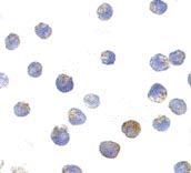 ab25884 at 10µg/ml staining Tuberin in L1210 cells by ICC/IF