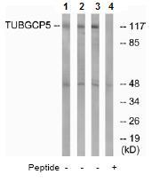 All lanes : Anti-TUBGCP5 antibody (ab74364) at 1/500 dilutionLane 1 : extracts from Jurkat cellsLane 2 : extracts from 293 cellsLane 3 : extracts from HT-29 cellsLane 4 : extracts from HT-29 cells with immunizing peptide at 10 µgLysates/proteins at 30 µg per lane.