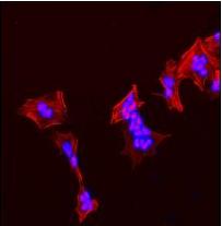 ab92305 at 1/100 dilution staining Tubulin Polymerization Promoting Protein in SH-SY5Y cells, by immunofluorescence.