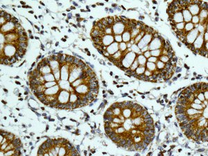 Immunohistochemical analysis of paraffin embedded Human colon tissue labeling TUFM with ab173300 at 1/100.
