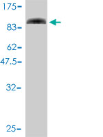 Western blot against tagged recombinant protein immunogen using ab56710 SLU7 antibody at 1ug/ml.