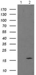 All lanes : Anti-Tumor protein D52 like 3 antibody [6E1] (ab128122) at 1/2000 dilutionLane 1 : HEK293T cell lysate transfected with pCMV6-ENTRY controlLane 2 : HEK293T cell lysate transfected with pCMV6-ENTRY Tumor protein D52 like 3 cDNALysates/proteins at 5 µg per lane.