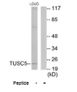 All lanes : Anti-TUSC5 antibody (ab64803) at 1/500 dilutionLane 1 : Extracts from LOVO cellsLane 2 : Extracts from LOVO cells plus peptide at 10µgLysates/proteins at 5 µg per lane.
