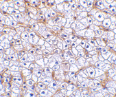 Immunohistochemistry of TWEAKR in human liver tissue with ab62496 antibody at 2.5 µg/ml.