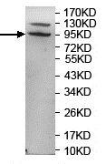 Anti-Two pore calcium channel protein 2 antibody (ab119915) at 1/500 dilution + MCF7 cell lysate