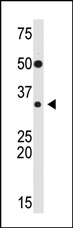 Anti-SLUG antibody (ab38551) at 1/100 dilution + Mouse heart tissue lysate