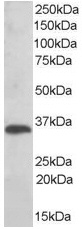 Anti-TXNDC antibody (ab37876) at 0.01 µg/ml + Human Liver lysate (35µg protein in RIPA buffer).developed using the ECL technique