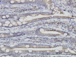 H00023071-M01 antibody (ab56990) used in immunohistochemistry at 3ug/ml on formalin fixed and paraffin embedded human small Intestine.