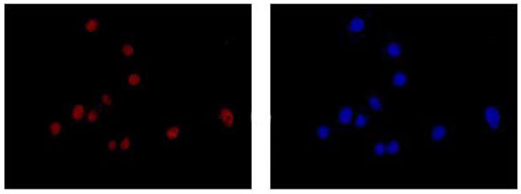 Immunofluorescent analysis of 4% paraformaldehyde-fixed U87-MG cells labeling TXNIP with ab188865 at 1/250 dilution followed by Goat anti rabbit IgG (Alexa Fluor® 555) secondary antibody at 1/200 dilution. Counter stained with Dapi (blue).