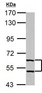 Anti-TXNRD1 antibody (ab155790) at 1/1000 dilution + Mouse brain extract/lysate at 50 µg