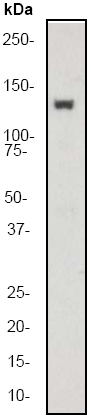 Anti-TYK2 antibody [EP1127Y] (ab52645) at 1/50000 dilution + Raji cell lysate at 10 µgSecondaryGoat anti-Rabbit HRP labeled at 1/2000 dilution