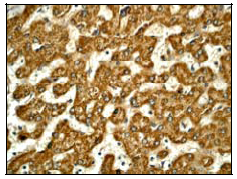ab52645 (1/100) staining TYK2 in paraffin embedded human liver tissue by Immunohistochemistry.