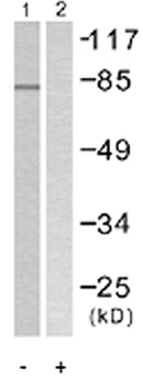 All lanes : Anti-Tyrosinase antibody (ab58450) at 1/500 dilutionLane 1 : extract of COS7 cells treated with UV (30 minutes)Lane 2 : extract of COS7 cells treated with UV (30 minutes) with immunizing peptide