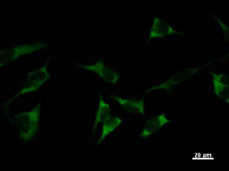 ab50961 at 1/10 dilution staining human YARS in HeLa cells by Immunocytochemistry. AlexaFluor 488 Goat anti-mouse IgG at 1/200 as secondary.