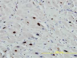 U1A antibody (ab55751) used in immunohistochemistry at 3ug/ml on formalin fixed and paraffin embedded human heart tissue.