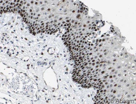 Image courtesy of Human Protein Atlas ab12290 stainning UBEC2 in the nucleus of surface epithelial cells of human esophagus. Paraffin-embbeded tissue was incubated with ab12290 (1/75 dilution) for 30 minutes at room temperature. Antigen retrieval was performed by heat induction in citrate buffer pH 6.ab12290 was tested in a tissue microarray (TMA) containing a wide range of normal and cancer tissues as well as a cell microarray consisting of a range of commonly used, well characterised human cell lines. Further results for this antibody can be found at www.proteinatlas.org