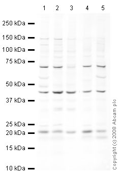 All lanes : Anti-UBE2C antibody (ab12290) at 1 µg/mlLane 1 : HeLa (Human epithelial carcinoma cell line) Whole Cell Lysate Lane 2 : Jurkat (Human T cell lymphoblast-like cell line) Whole Cell Lysate Lane 3 : Jurkat (Human T cell lymphoblast-like cell line) Nuclear Lysate (ab14844)Lane 4 : A431 (Human epithelial carcinoma cell line) Whole Cell Lysate Lane 5 : HEK293 Human embryonic kidney cell line Whole Cell Lysate Lysates/proteins at 10 µg per lane.SecondaryIRDye 680 Conjugated Goat Anti-Rabbit IgG (H+L) at 1/10000 dilution