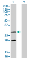 All lanes : Anti-Smac / Diablo antibody (ab68352) at 1 µg/mlLane 1 : Smac / Diablo transfected 293T cell lysateLane 2 : Non-transfected 293T cell lysateLysates/proteins at 25 µg per lane.SecondaryGoat Anti-Mouse IgG (H&L)-HRP Conjugate at 1/2500 dilution