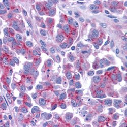 ab10919, at a dilution of 5 µg /ml, staining Smac/Diablo in human ovary tissue by Immunohistochemistry (Formalin/PFA-fixed paraffin-embedded sections).