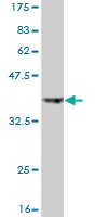 Western blot against tagged recombinant protein immunogen using ab57188 UBE2D4 antibody at 1ug/ml.