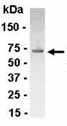 Anti-UBE2D4 antibody (ab37510) at 1/2000 dilution + E. coli-derived fusion protein at 2.5 µgSecondaryGoat anti-IgY-HRP at 1/1000 dilution