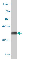 Western blot against tagged recombinant protein immunogen using ab58254 UBE2E2 antibody at 1ug/ml.