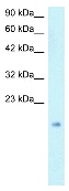 Anti-Smac / Diablo antibody (ab23450) at 1 µg/ml + HepG2 lysateSecondaryHRP conjugated anti-Rabbit IgG (1: 50,000-100,000)
