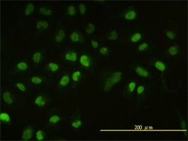 Ube2H antibody (ab58261) used in immunofluorescence at 10ug/ml on HeLa cells.