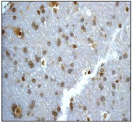 ab75854, at 1/100 dilution, staining UBE2I / UBC9 in human brain, by Immunohistochemistry using formalin-fixed, paraffin-embedded tissue.