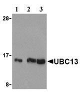 All lanes : Anti-Ube2N / Ubc13 antibody (ab25885) (analysis in human small intestine cell lysates 15ug/lane )Lane 1 : 0.5 ug/ml of antibody.Lane 2 : 1 ug/ml of antibody.Lane 3 : 2 ug/ml of antibody.