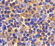 ab25885 at 2µg/ml staining UBe2N in mouse thymus tissue by IHC