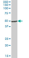 Anti-Ubiquinol-Cytochrome C Reductase Core Protein I antibody (ab88363) at 1 µg/ml + Human spleen tissue lysate at 50 µgSecondaryGoat anti-Mouse IgG at 1/5000 dilution