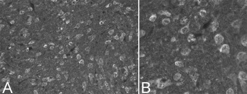 ab7780 at a dilution of 1/1000, staining Ubiquitin in neurons (Alexa 488 secondary at 1/2000) on 30µm coronal rat brain (ab29475) tissue sections in free floating IHC (see protocol link for detailed description). Image shows neuronal staining observed with [A] 20x objective and [B] 40x objective.NB: No labeling observed following omission of primary antibody.Sections were viewed using an Axioplan 2 Imaging microscope (Imaging Associates) fitted with 10x, 20x and 40x Plan-Neofluorobjectives (Zeiss, Germany) and images were taken using a AxioCam Hrm digital camera (Zeiss, Germany) and AxioVision software (Imaging Associates).