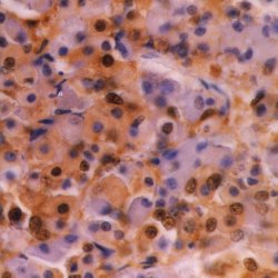 ab122 staining Ubiquitin in the tissue of human hypophysis by Immunohistochemistry (Formalin/PFA-fixed paraffin-embedded sections).