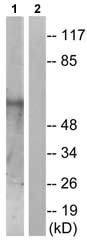 All lanes : Anti-Smad1 (phospho S187) antibody (ab73211) at 1/500 dilutionLane 1 : Mouse muscle cell extractLane 2 : Mouse muscle cell extract with immunising phosphopeptide at 10 µgLysates/proteins at 30 µg per lane.