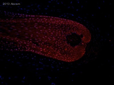 ab73211 staining Smad1 (phospho S187) in Human skin, hair follicle tissue sections by Immunohistochemistry (IHC-Fr - frozen sections). Tissue was fixed with formaldehyde and blocked with 10% serum for 30 minutes at 25°C. Samples were incubated with primary antibody (1/100 in PBS) for 16 hours at 4°C. A TRITC-conjugated Goat anti-rabbit polyclonal (1/200) was used as the secondary antibody.See Abreview