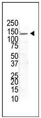 Anti-UBPY/USP8 antibody (ab59949) at 1/100 dilution + Transfected 293T cells