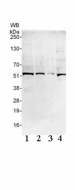 All lanes : Anti-UBXN6 antibody (ab103526) at 0.1 µg/mlLane 1 : HeLa Whole cell lysate at 50 µgLane 2 : HeLa whole cell lysate at 15 µgLane 3 : HeLa whole cell lysate at 5 µgLane 4 : 293T whole cell lysate at 50 µgdeveloped using the ECL technique