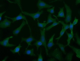 ab123939, at 1/100 dilution, staining UCK in HeLa cells by Immunofluorescence.
