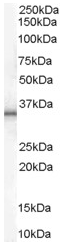 Anti-UCP1 antibody - Carboxyterminal end (ab47991) at 1 µg/ml + Human Adipose lysate (35µg protein in RIPA buffer).