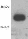 Anti-UCP3 antibody (ab3477) at 1 µg/ml + Recombinant human UCP3